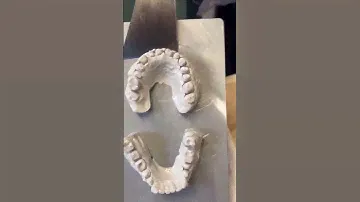 Which resin do you use for dental model 3D printing?