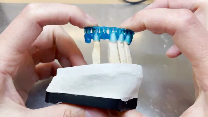 3D Print in Dental Cast Application
